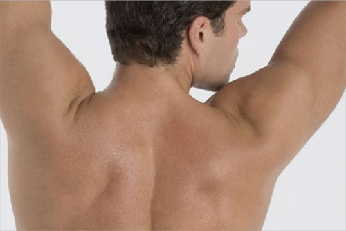 hair-removal-lead-image