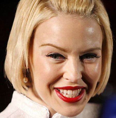 kylie-botox
