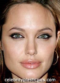 angelina_jolie_after1