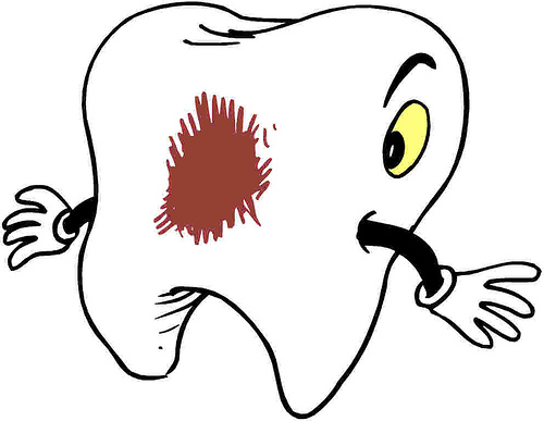 Caries