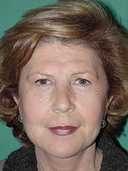 cirugia estética cuello