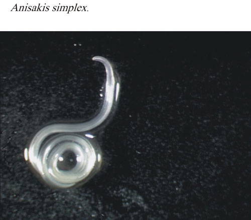 anisakis-1