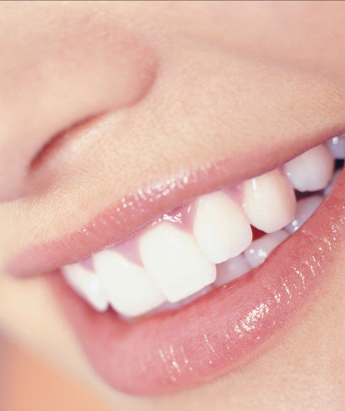 sonrisa-blanca