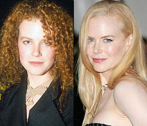nicole-kidman