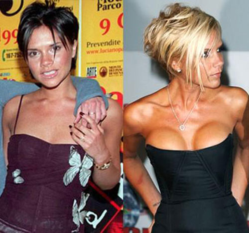 victoria-beckham-transformacion
