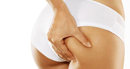 celulitis1