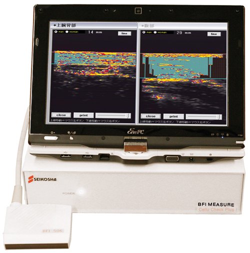 Equipo-Cellucheck-Quantum-Technology2