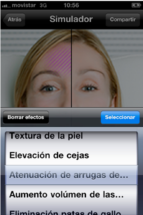 skinlogc-iphone