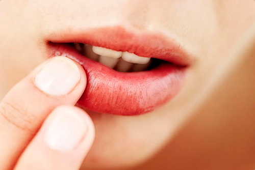 Imagen labio con herpes