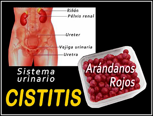 cistitis arandanos
