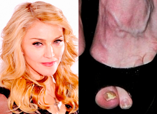 madonna presenta fragancia con hongo en las unas de los pies