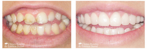 Estética Dental Un Libro Lleno De Sonrisas Creadas Por El Dr Augusto Morillo Bellezapura