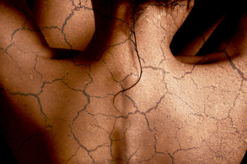 Que de las pecas de la crema las revocaciones
