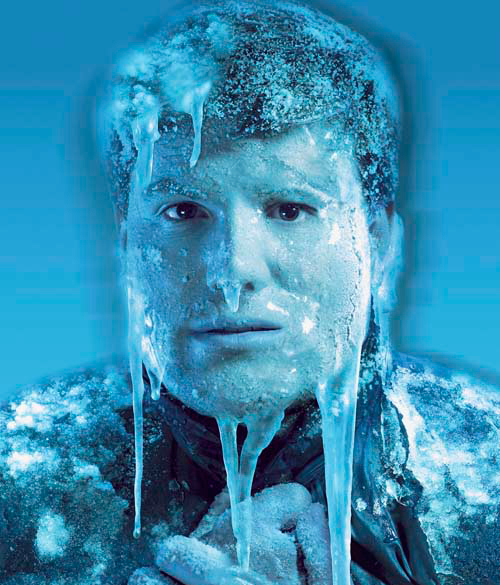 frotox-nuevo-botox-nervios-congelados-arrugaas-frente