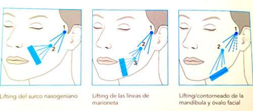 ingenieria-facial-clinica-tufet-envejecimiento