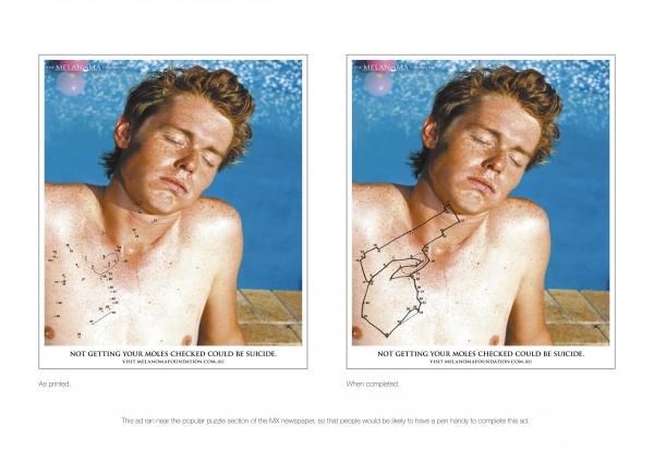 cancer de piel avene