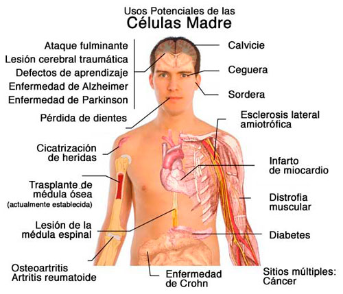 tratamientos células madre