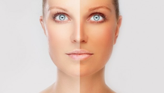 Mujer mitad blanca, mitad bronceada