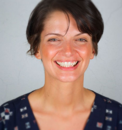 blanqueamiento dental despues