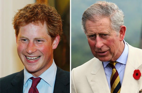 rosacea-principe-harry-carlos-inglaterra