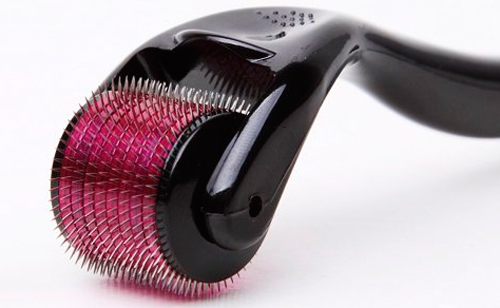 microneedling-rodillo-medicina-estetica-rejuvenecimiento