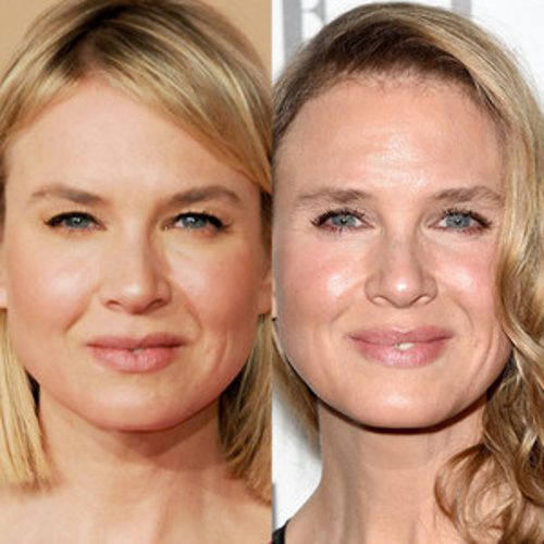 Renee Zellweger antes y después