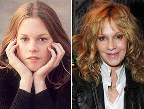 Melanie-Griffith, antes y después. ¿Fue a un cirujano a un médico estético o a un cirujano cosmético.