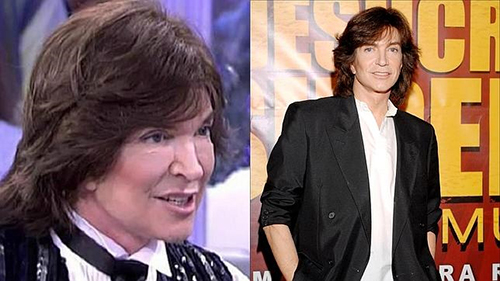 inyectables-faciales-eterna-juventud-3