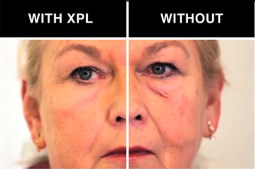 xpl skin piel antiaging