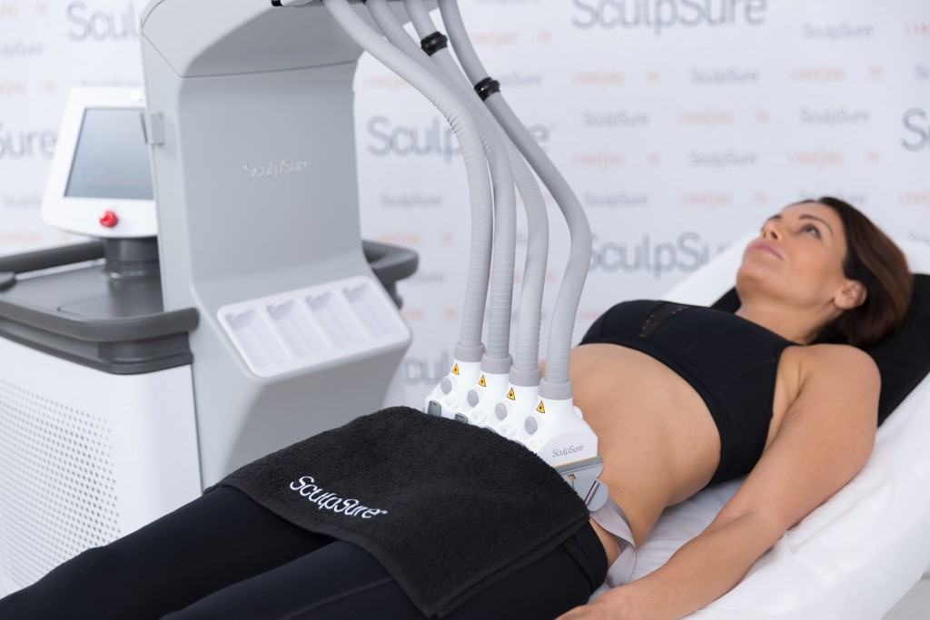 Foto SCULPSURE