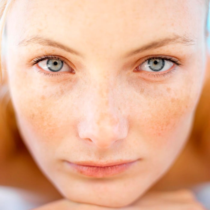 manchas-piel-melascreen-ducray