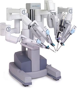 Robot Da Vinci, empleado para operar a pacientes con endometriosis.