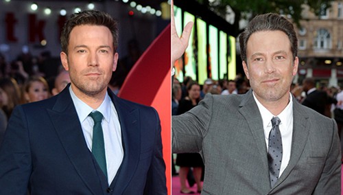 famosos-operados-4 famosos-operados-4