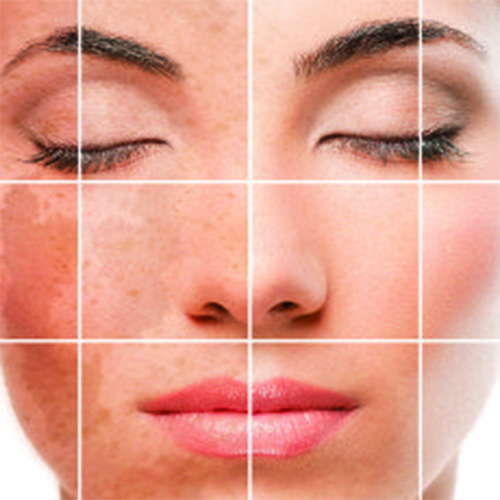 Peeling, 3Step Peel, Piel tersa