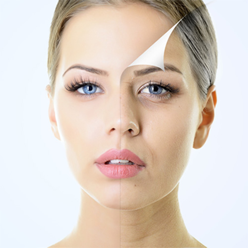 blefaroplastia, párpados, arrugas