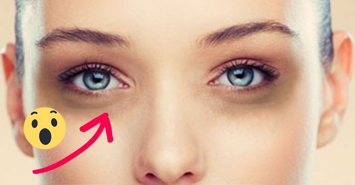 Ojeras