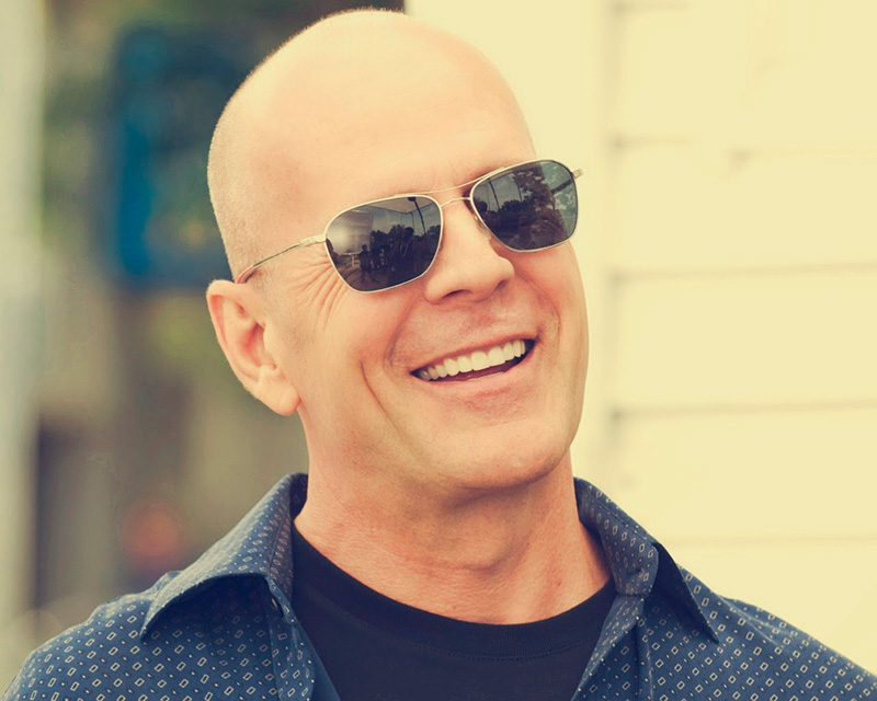 Bruce Willis Alopecia Androgenetica