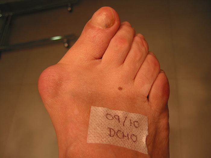 Pre Operatorio