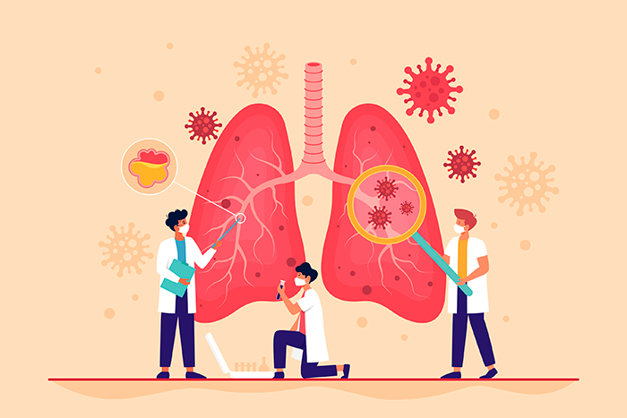 Pulmones Covid19