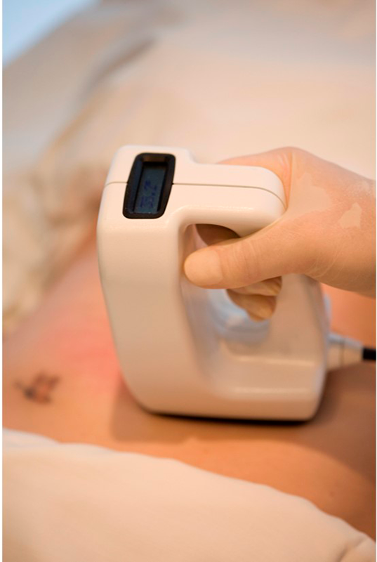 Lipolipólisis