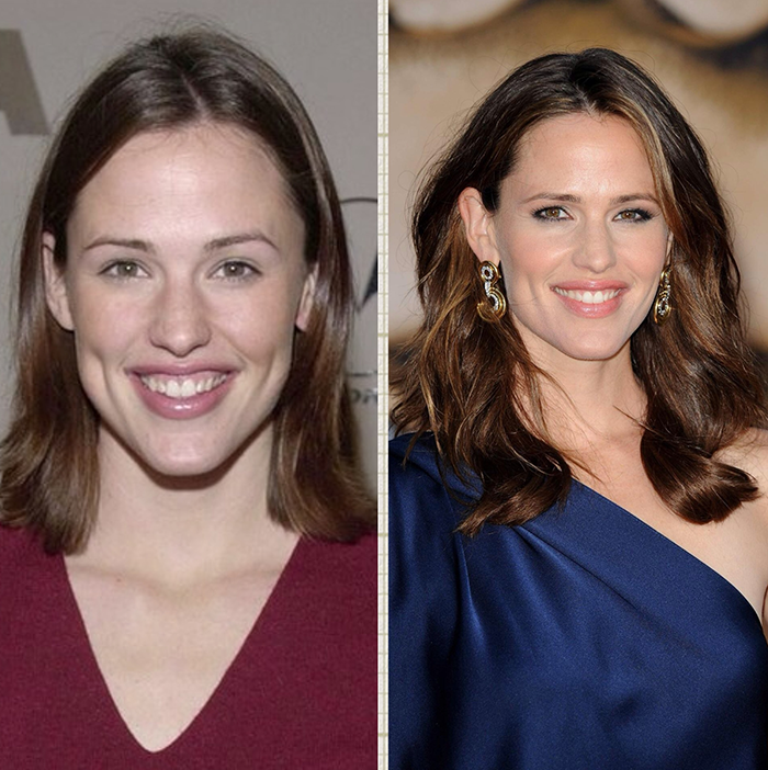 Jennifer Garner sonrisa gingival