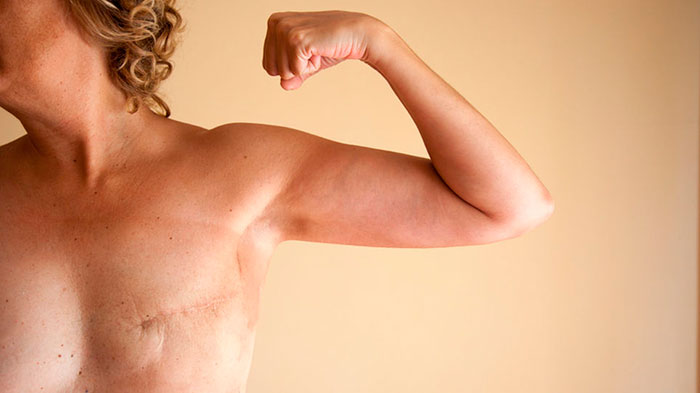 Reconstrucción Mamaria