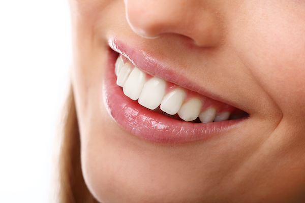 ¿Soy buena candidata al blanqueamiento dental?