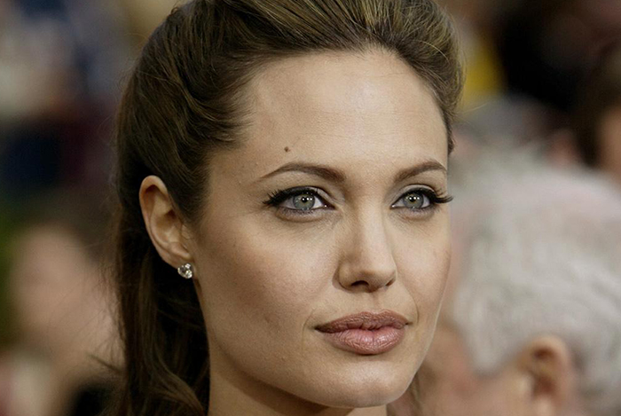 Labios A Medida Acido Hialuronico