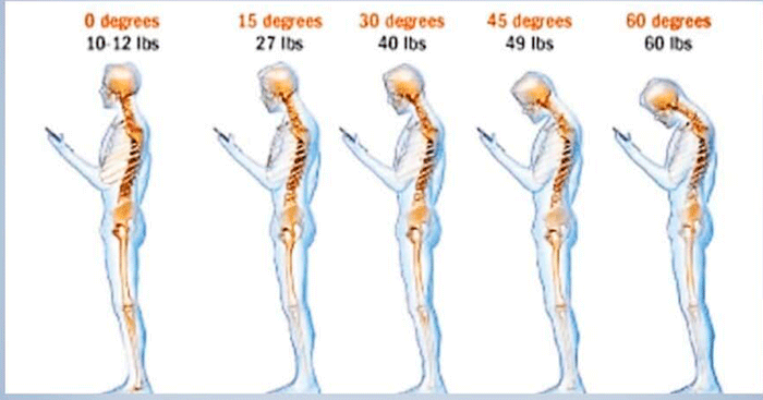 prevenir cuello tecnologico