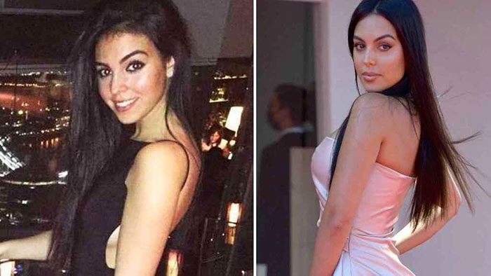 Antes y después de Gio georgina-2