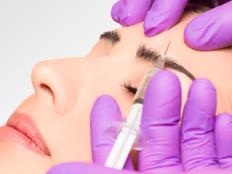 Baby Botox Toxina Botulinica Tipo A neuromoduladores
