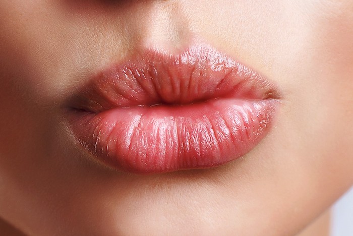 Operación labios al descubierto: más jóvenes y con color natural