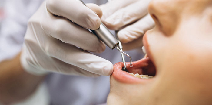 salud-bucodental-cancer-mama-1