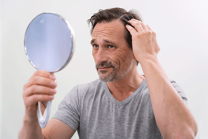 tratamientos contra la alopecia